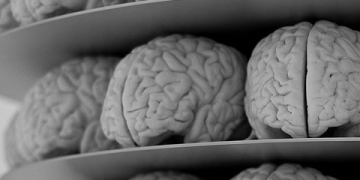 Understanding the Brain Though Dimensionality Reduction