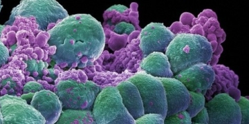 Researchers Now Have Access to National Institutes of Health’s Medline Data Repository