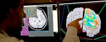 Big Data Fuels Breakthrough In Alzheimer'S Research