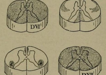 Google & Biogen Team to Use Wearable Sensors to Study Multiple Sclerosis Progression through Sensors and Data Analysis