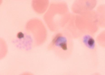 Eve Stumbles Upon a Possible Cure for Malaria. Eve is a Robot Scientist.