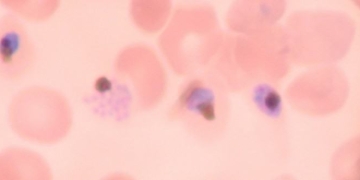 Eve Stumbles Upon a Possible Cure for Malaria. Eve is a Robot Scientist.