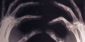 Open-Sourcing the Human Body  With the “Open Humans” Platform