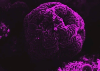 How to get Business Insights from Artificial Intelligence (when you really need them)