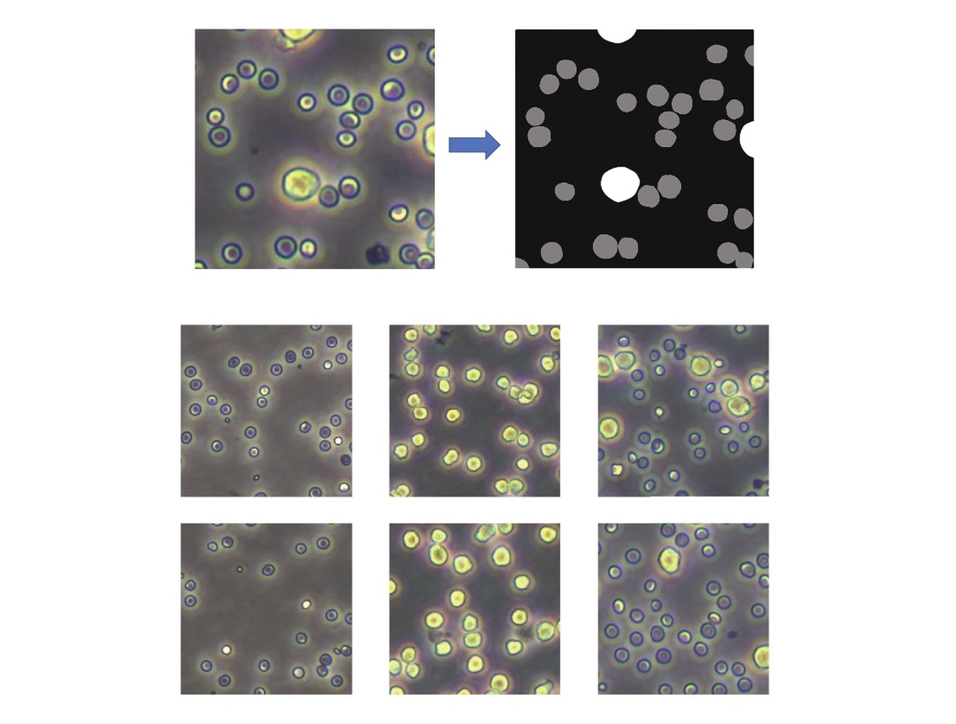CNNs have been used to identify cells in photos that include only a single type of cell. nvolvement. The ML method capable of count cells aims to eliminate human involvement.
