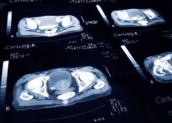 This ML algorithm identifies undiagnosable cancers This ML algorithm identifies undiagnosable cancers