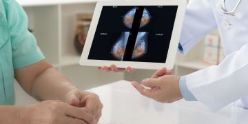 Google develops AI breast cancer screening tools with iCAD