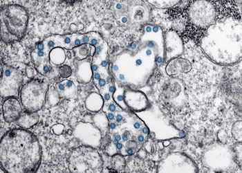 Listeria outbreak spreads to 15 states: Is your food safe?