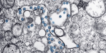 Listeria outbreak spreads to 15 states: Is your food safe?