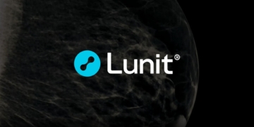 Lunit AI demonstrates improved breast cancer detection in large-scale study