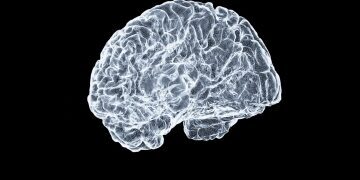 Why doctors believe this new AI system will end MRI wait times