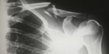 AI-generated medical scans prove nearly indistinguishable from reality
