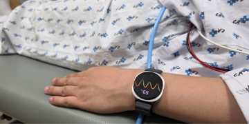 Galaxy Watch 6 predicts fainting with 84% accuracy, says study